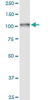 Anti-ADD2 Rabbit Polyclonal Antibody