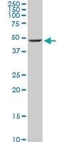 Anti-ENO1 Mouse Monoclonal Antibody [clone: 3C8]