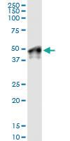 Anti-WNT5B Rabbit Polyclonal Antibody