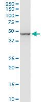 Anti-ENO1 Mouse Monoclonal Antibody [clone: 3C8]