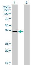 Anti-HOXD8 Mouse Monoclonal Antibody [clone: 10F8]