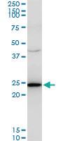 Anti-TPT1 Mouse Monoclonal Antibody [clone: 2A3]