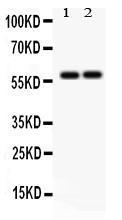 Anti-SCARB1 Rabbit Polyclonal Antibody