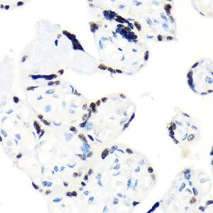 Immunohistochemistry analysis of paraffin-embedded human placenta using Anti-RCC1 Antibody [ARC1834] (A307816) at a dilution of 1:100 (40x lens) Perform microwave antigen retrieval with 10 mM Tris/EDTA buffer pH 90 before commencing with IHC staining protocol