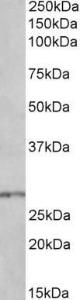 Anti-HOXB9 Antibody (A84806) (0.3µg/ml) staining of Mouse Spinal Cord lysate (35µg protein in RIPA buffer). Primary incubation was 1 hour. Detected by chemiluminescence.