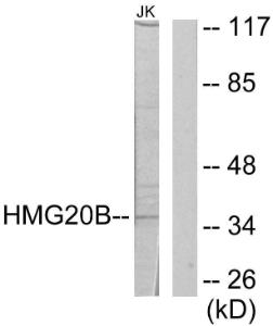 Western blot analysis of lysates from Jurkat cells using Anti-HMG20B Antibody. The right hand lane represents a negative control, where the antibody is blocked by the immunising peptide.