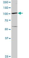 Anti-UBA7 Rabbit Polyclonal Antibody