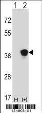 Anti-MAP2K3 Rabbit Polyclonal Antibody (FITC (Fluorescein Isothiocyanate))