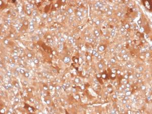 Antibody anti-cytokeratin 8 RB221 100 µg