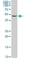 Anti-ENO1 Mouse Monoclonal Antibody [clone: 1G1]