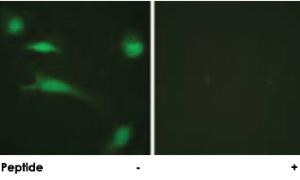 Anti-TP53 Rabbit Polyclonal Antibody