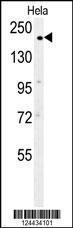 Anti-CLTC Rabbit Polyclonal Antibody (HRP (Horseradish Peroxidase))