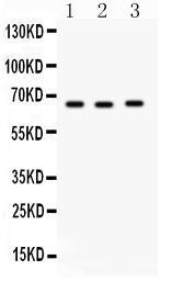 Anti-SLC19A1 Rabbit Polyclonal Antibody