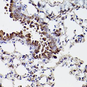 Immunohistochemistry analysis of paraffin-embedded mouse lung using Anti-P4HB Antibody (A8454) at a dilution of 1:100 (40x lens). Perform high pressure antigen retrieval with 10 mM citrate buffer pH 6.0 before commencing with IHC staining protocol