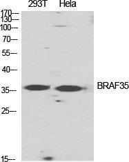 Western blot analysis of various cells using Anti-HMG20B Antibody