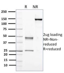 Anti-Nucleophosmin Mouse Monoclonal Antibody [clone: NPM1/3398]