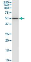 Anti-ENO1 Mouse Monoclonal Antibody [clone: 1G1]