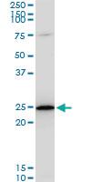 Anti-TPT1 Mouse Monoclonal Antibody [clone: 2A3]