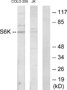 Antibody anti-S6K 100 µg