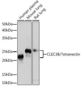 Anti-Tetranectin antibody