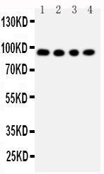 Anti-ADAM17 Rabbit Polyclonal Antibody