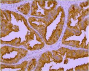 Anti-PSMA/FOLH1/NAALADase I Mouse Monoclonal Antibody [clone: GCP-04]