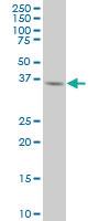 Anti-AURKB Mouse Monoclonal Antibody [clone: 5H7]