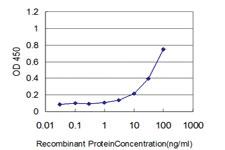 Anti-HSPB8 Mouse Monoclonal Antibody [clone: 5B12]