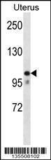 Anti-MOV10 Rabbit Polyclonal Antibody (AP (Alkaline Phosphatase))