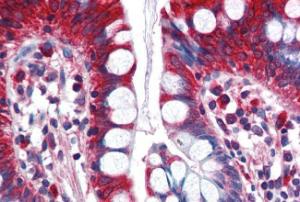 Anti-ACSL5 Antibody (A83201) (5 µg/ml) staining of paraffin embedded Human Small Intestine. Steamed antigen retrieval with citrate buffer pH 6, AP-staining