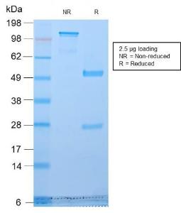 SDS-PAGE analysis of Anti-Golgi Complex Antibody [GLG1/2829R] under non-reduced and reduced conditions; showing intact IgG and intact heavy and light chains, respectively. SDS-PAGE analysis confirms the integrity and purity of the Antibody