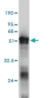 Anti-RNF114 Mouse Monoclonal Antibody [clone: 4G3-1A10]