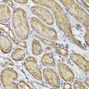 Immunohistochemistry analysis of paraffin-embedded rat kidney using Anti-P4HB Antibody (A8454) at a dilution of 1:100 (40x lens). Perform high pressure antigen retrieval with 10 mM citrate buffer pH 6.0 before commencing with IHC staining protocol