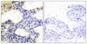 Antibody anti-S6K 100 µg