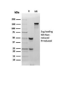 Antibody anti-cytokeratin 8 RB221 100 µg