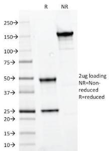 SDS-PAGE analysis of Anti-PAX7 Antibody [PAX7/497] under non-reduced and reduced conditions; showing intact IgG and intact heavy and light chains, respectively. SDS-PAGE analysis confirms the integrity and purity of the antibody.