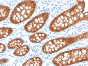 Immunohistochemical analysis of formalin-fixed, paraffin-embedded human colon using Anti-Villin Antibody [VIL1/4107R]