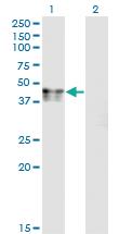 Anti-CANT1 Mouse Monoclonal Antibody [clone: 2D3]