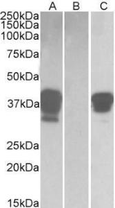 HEK293 lysate (10ug protein in RIPA buffer) overexpressing Human POU2AF1 with DYKDDDDK tag probed with Anti-POU2AF1 Antibody (A84808)(1 µg/ml) in Lane A and probed with anti- DYKDDDDK Tag (1/3000) in lane C.