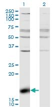 Anti-ZBP1 Mouse Monoclonal Antibody [clone: 2C10]