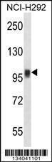 Anti-NFATC1 Rabbit Polyclonal Antibody (AP (Alkaline Phosphatase))