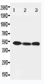 Anti-Beclin 1 Rabbit Polyclonal Antibody