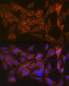 Anti-Tetranectin antibody