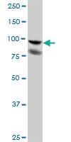 Anti-PDCD6IP Mouse Polyclonal Antibody