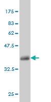 Anti-MUC5AC Mouse Monoclonal Antibody [clone: 2H7]