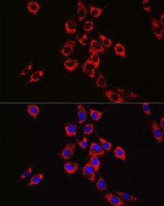 Immunofluorescence analysis of NIH/3T3 cells using Anti-P4HB Antibody (A8454) at a dilution of 1:100 (40x lens). DAPI was used to stain the cell nuclei (blue)