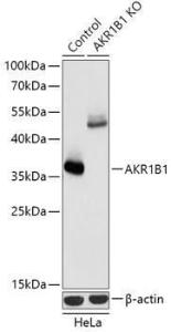 Western blot analysis of extracts from normal (control) and AKR1B1 knockout (KO) HeLa cells, using Anti-Aldose reductase Antibody (A92897) at 1:1,000 dilution. The secondary antibody was Goat Anti-Rabbit IgG H&L Antibody (HRP) at 1:10,000 dilution.