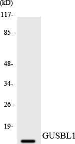 Western blot analysis of the lysates from HT 29 cells using Anti-GUSBL1 Antibody