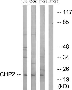 Western blot analysis of lysates from HT-29, K56 and Jurkat cells using Anti-CHP2 Antibody. The right hand lane represents a negative control, where the antibody is blocked by the immunising peptide