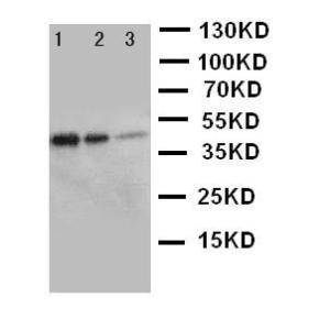 Anti-ErbB 3 Rabbit Polyclonal Antibody